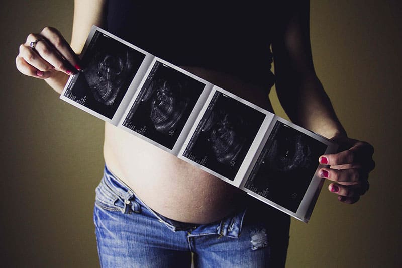 schwangere Frau, die Ultraschallbilder ihres Babys hält